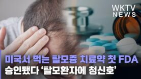 미국서 먹는 탈모증 치료약 첫 FDA 승인됐다 ‘탈모환자에 청신호’