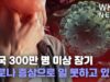미국 300만 명 이상 장기 코로나 증상으로 일 못하고 있다