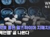 더 약효 좋은 알츠하이머 치매치료제 ‘리케인맵’ 곧 나온다