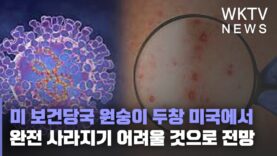 미 보건당국 원숭이 두창 미국에서 완전 사라지기 어려울 것으로 전망