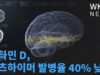 비타민 D, 알츠하이머 발병율 40% 낮춰
