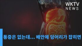 통증은 없는데 배안에 덩어리가 잡히면…