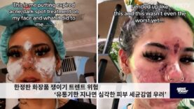 한정판 화장품 쟁이기 트렌트 위험 ‘유통기한 지나면 심각한 피부 세균감염 우려’