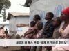새로운 M 폭스 변종 ‘세계 보건 비상 주의보’