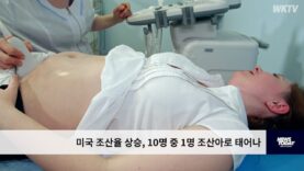 미국 조산율 상승, 10명 중 1명 조산아로 태어나